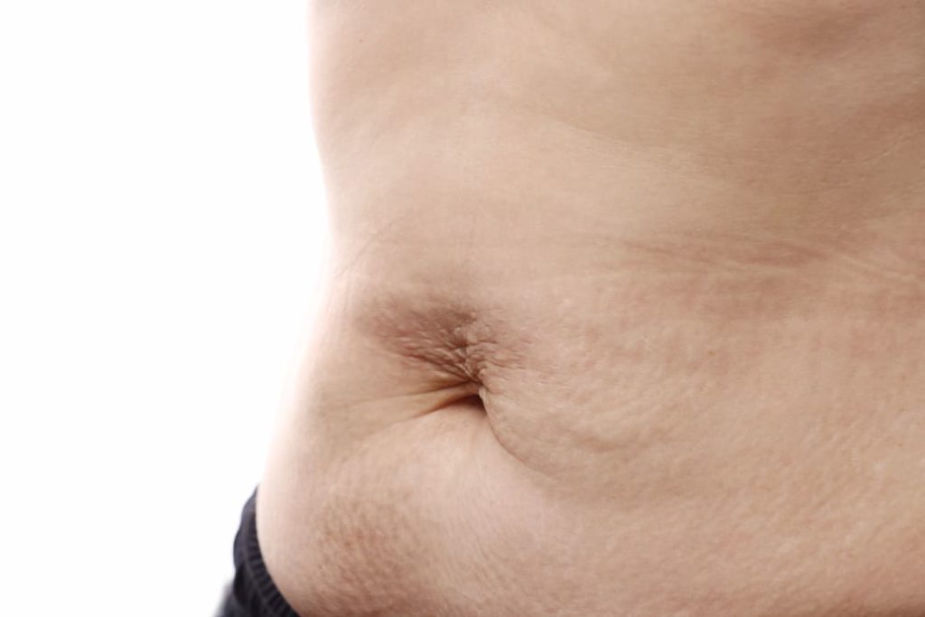 luzna-skora-na-brzuchu